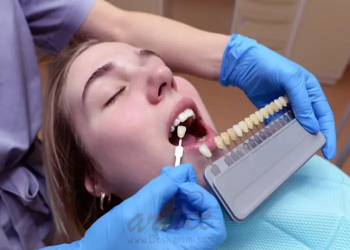 لمینت دندان برای زنان باردار چگونه انجام می‌شود؟