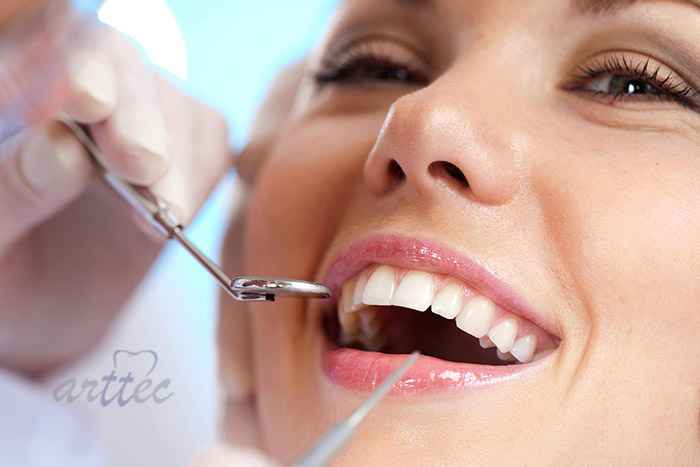 هزینه بلیچینگ دندان و مراقبت های پس از بلیچینگ