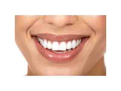 روشهای دندانپزشک زیبایی