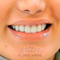 متخصص دندانپزشکی زیبایی