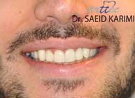 بهترین دندانپزشک زیبایی تهران